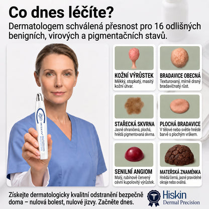 Oficiální značkový obchod🖊️|🎁 Hiskin® 7denní odstraňovač skvrn a pigmentových skvrn (Bezbolestný rollerball bez jizev)🐬