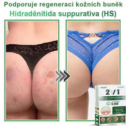 HAJUEI® 📌 𝟐𝐯𝟏 𝐡𝐲𝐝𝐫𝐨𝐤𝐨𝐥𝐨𝐢𝐝𝐧í 𝐧á𝐩𝐥𝐚𝐬𝐭𝐢 𝐬 𝐦𝐢𝐤𝐫𝐨𝐣𝐞𝐡𝐥𝐢č𝐤𝐚𝐦𝐢 | 𝐒𝐩𝐞𝐜𝐢á𝐥𝐧ě 𝐯𝐲𝐯𝐢𝐧𝐮𝐭é 𝐩𝐫𝐨 𝐨𝐝𝐬𝐭𝐫𝐚𝐧ě𝐧í 𝐯𝐲𝐬𝐭𝐨𝐮𝐩𝐥ý𝐜𝐡 𝐦𝐚𝐭𝐞ř𝐬𝐤ý𝐜𝐡 𝐳𝐧𝐚𝐦é𝐧𝐞𝐤, 𝐚𝐤𝐧é, 𝐩𝐥𝐨𝐜𝐡ý𝐜𝐡 𝐛𝐫𝐚𝐝𝐚𝐯𝐢𝐜 𝐚 𝐤𝐨ž𝐧í𝐜𝐡 𝐯ý𝐫ů𝐬𝐭𝐤ů | 𝐁𝐚𝐥𝐞𝐧í 𝟏𝟒𝟒 𝐤𝐮𝐬ů🌵🌵