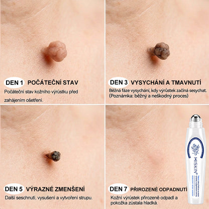 Oficiální značkový obchod🖊️|🎁 Hiskin® 7denní odstraňovač skvrn a pigmentových skvrn (Bezbolestný rollerball bez jizev)🐬