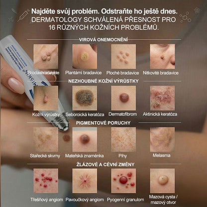 Oficiální značkový obchod🖊️|🎁 Hiskin® 7denní odstraňovač skvrn a pigmentových skvrn (Bezbolestný rollerball bez jizev)🐬